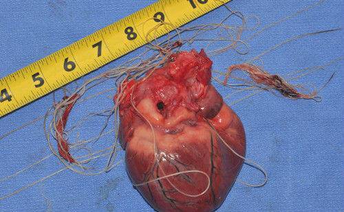 паразиты сердца